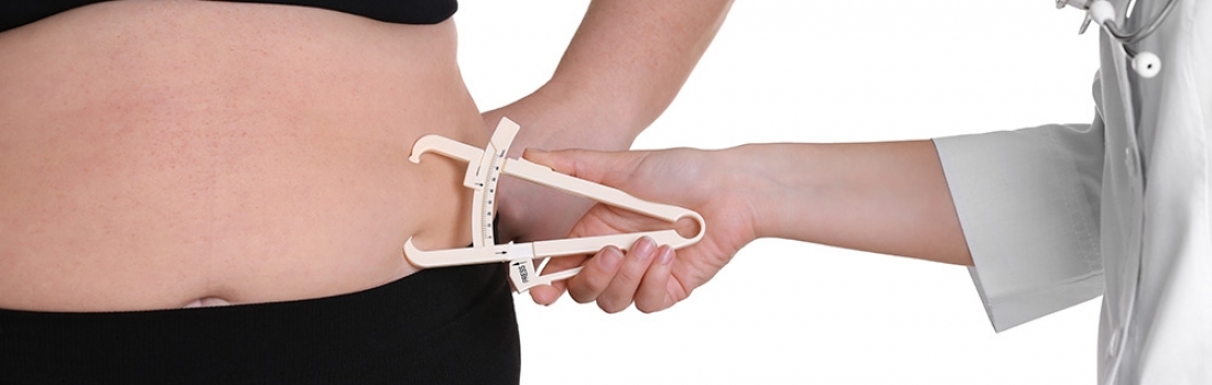 ¿CÓMO ACEPTAR QUE TENGO OBESIDAD O SOBREPESO?