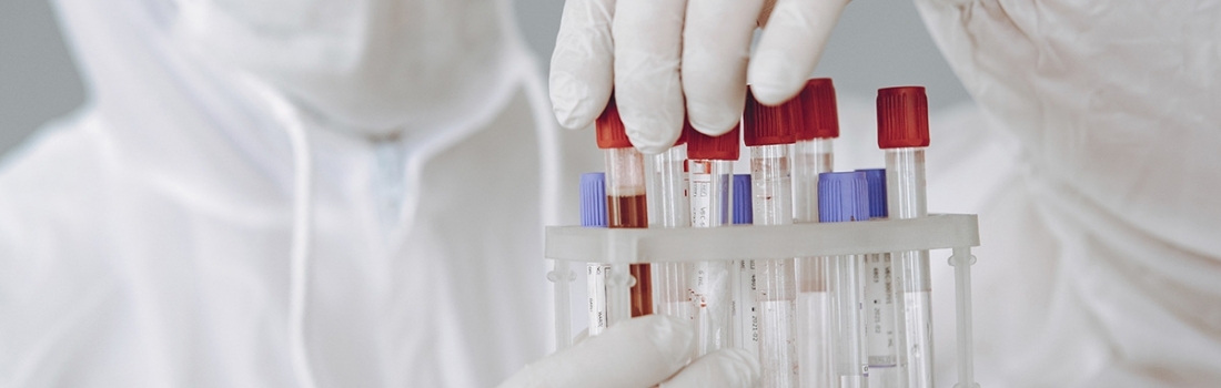 Estudios indispensables para el control