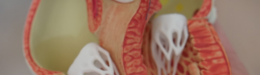 Tuberías limpias